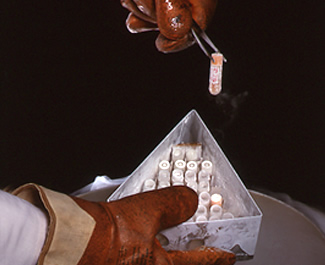 Frozen cell samples for research
